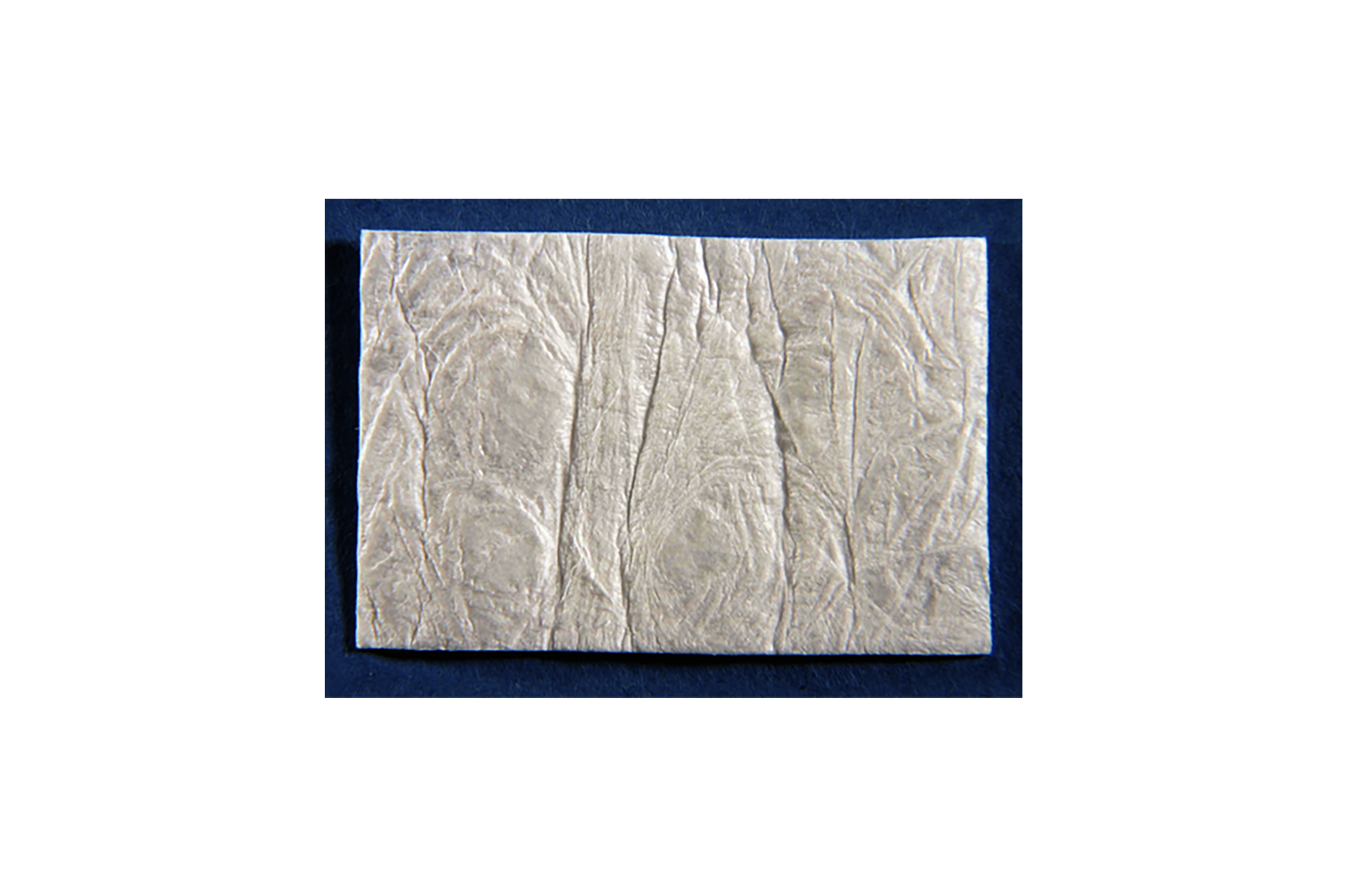 Symbios OsteoShield Collagen Resorbable Membrane
