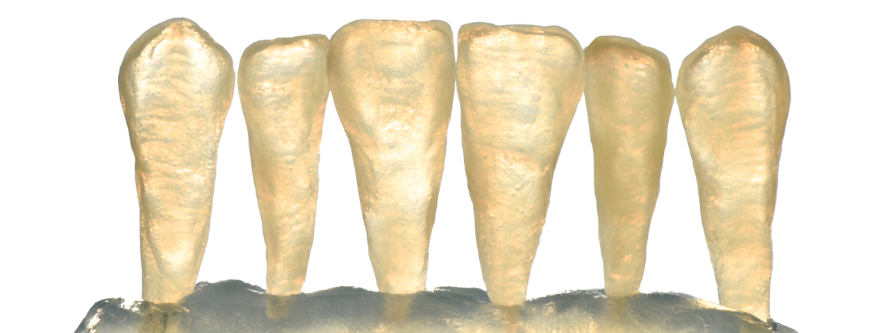 Image of Celtra Press zirconia reinforced lithium disilicate restoration samples showing the opalescence of the product in sunlight