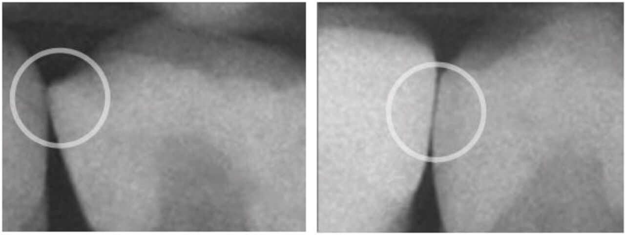 Poor contact vs proper contact