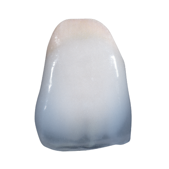 we bim age showing an incisor made from Kiss materials