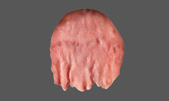 modeling image of an incisal tooth showing the Kiss ceramics concept