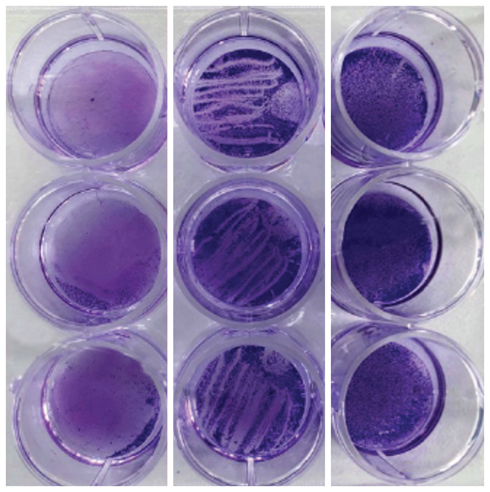 Image of Petri Dishes showing the results of ultrasonic scaling, hand scaling and untreated